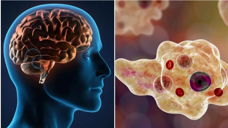 केरल में दिमाग खाने वाले अमीबा से दहशत ! एक महीने में 6 मौतें, मलप्पुरम के 47 वर्षीय शख्स की भी जान गई 2 image 57